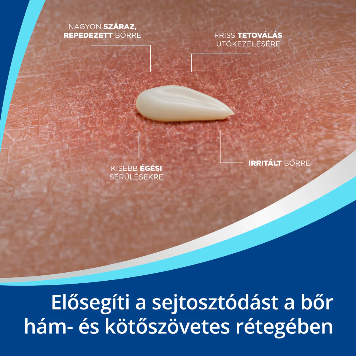 Bepanthen kenőcs 100g - Image 7