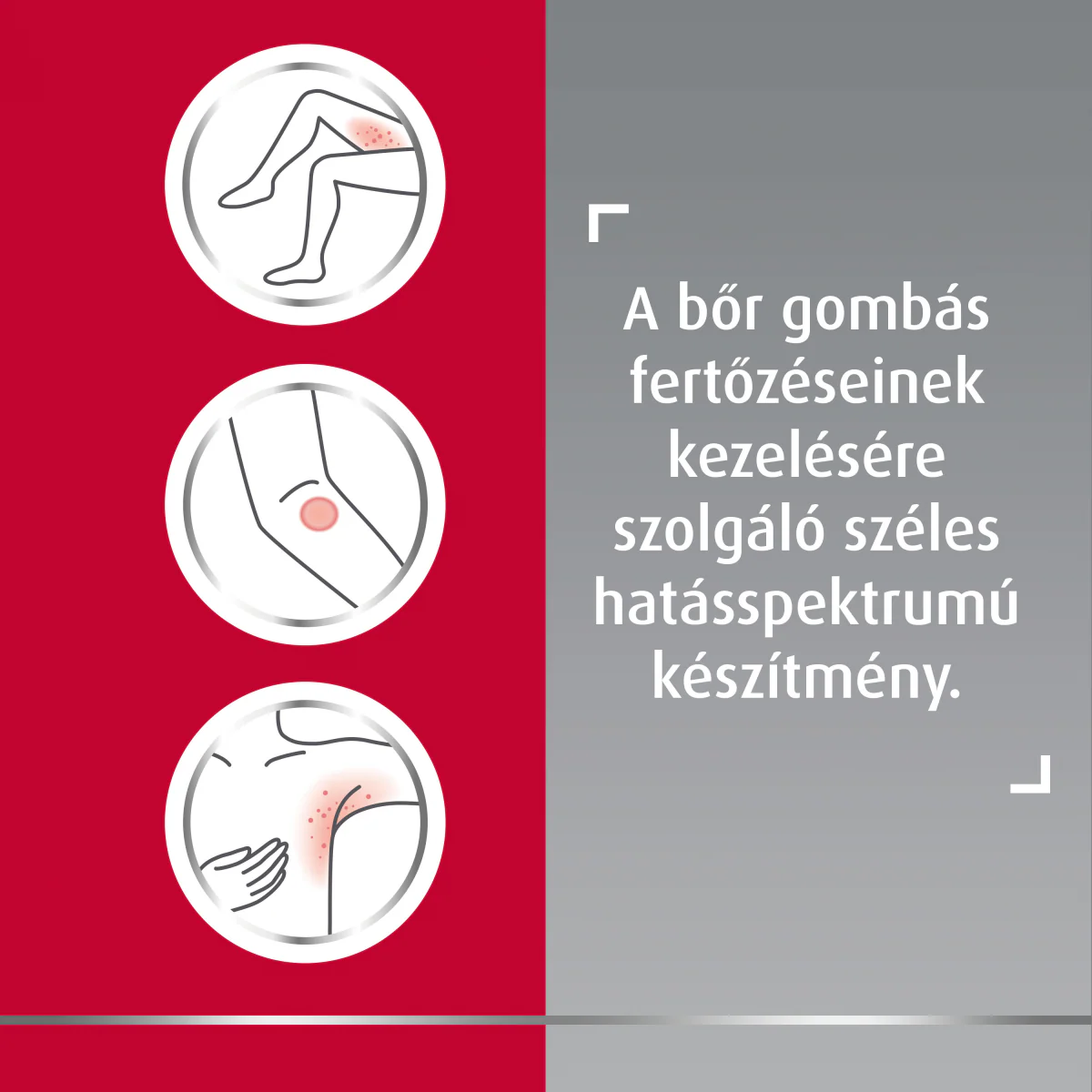Canesten 10 mg/g krém 30g - Image 20