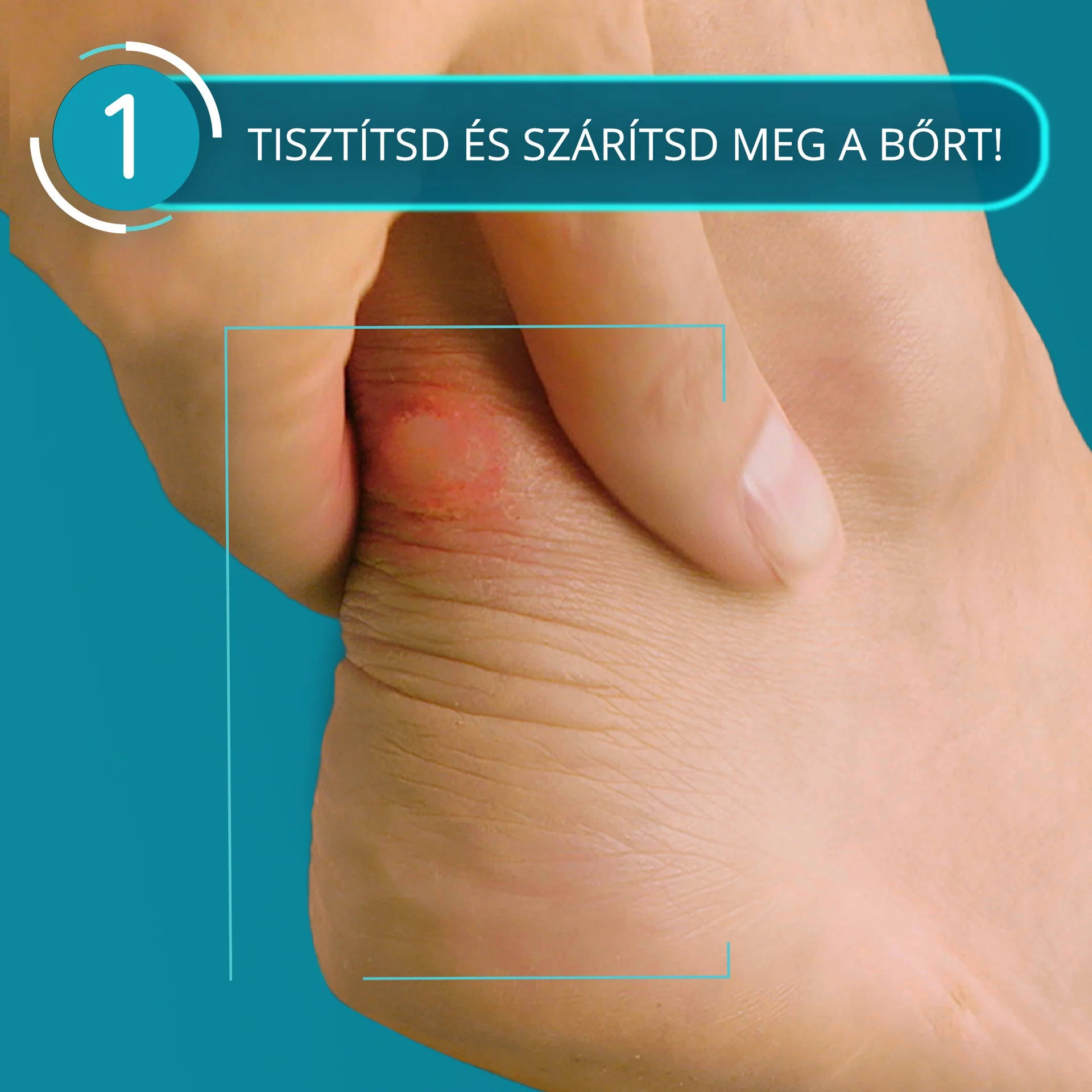 Compeed vízhólyagtapasz vegyes 5 db - Image 10