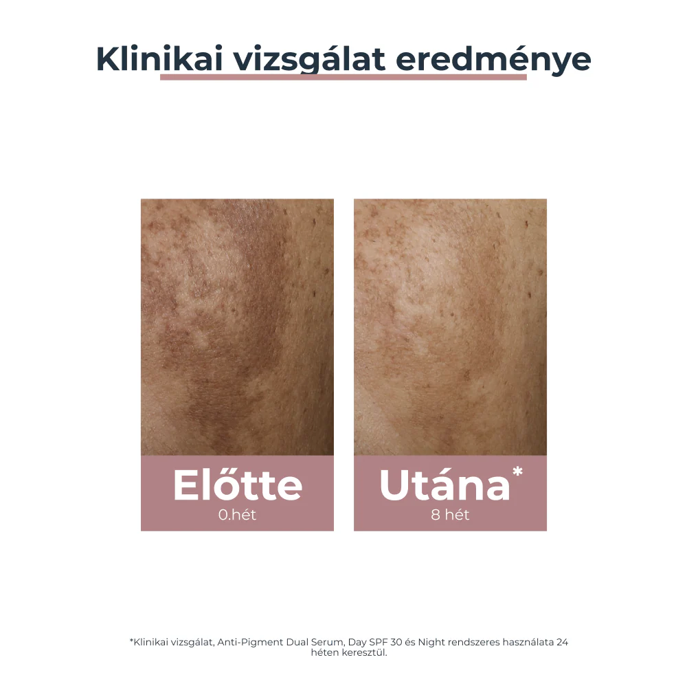 Eucerin Anti-Pigment Duál Szérum 30 ml - Image 3