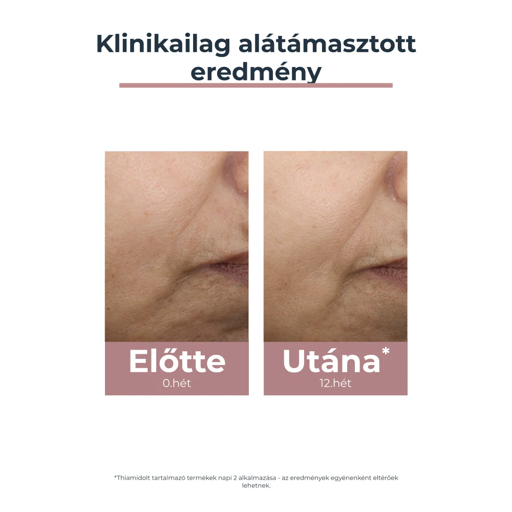 Eucerin Anti-Pigment színezett nappali arckrém medium SPF30 50ml - Image 6