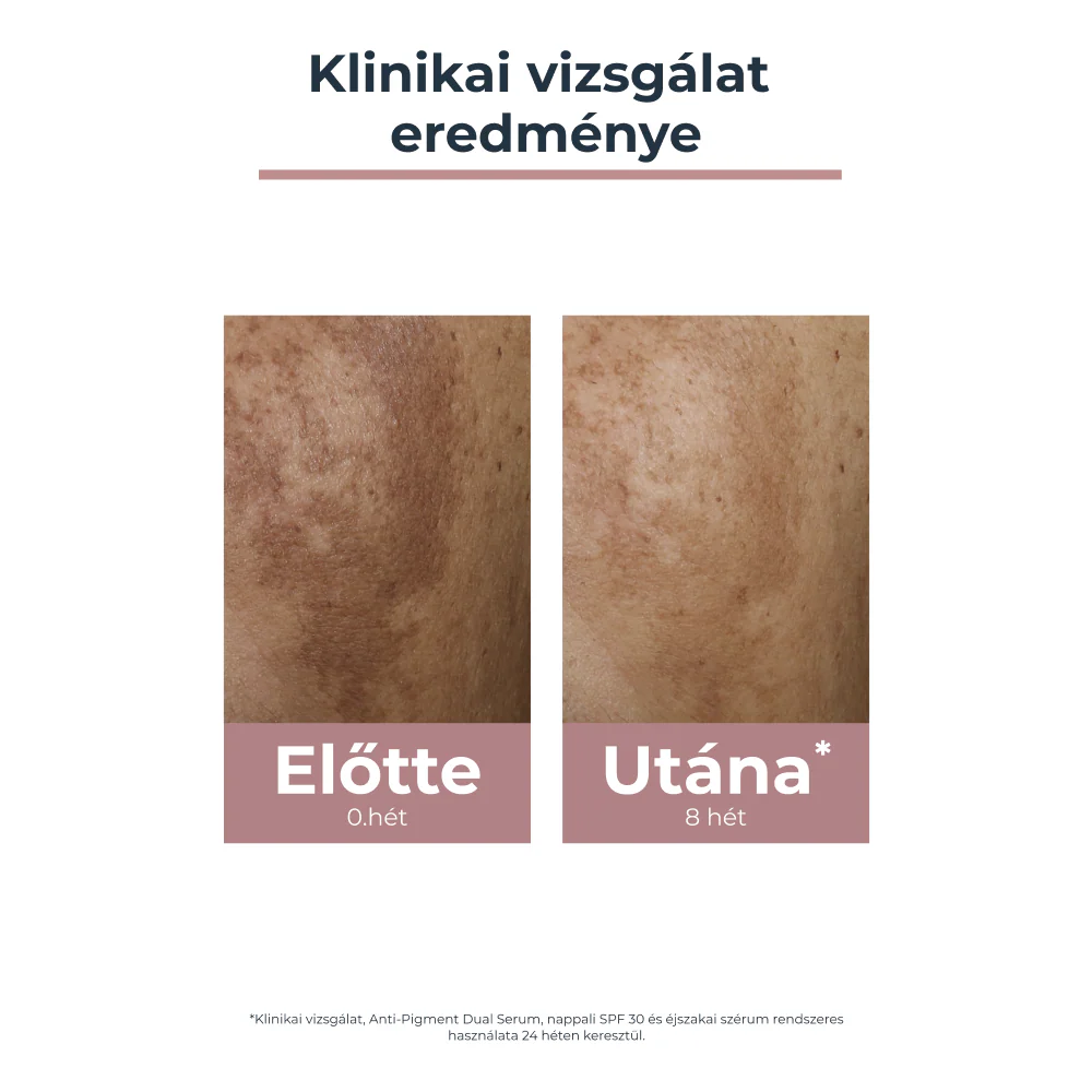 Eucerin Anti-Pigment éjszakai arckrém 50ml - Image 6