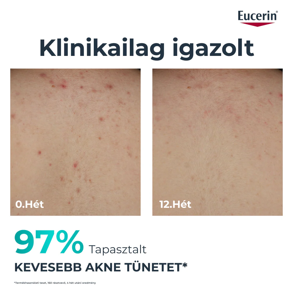 Eucerin DermoPure Clinical Correcting Body Care - Testkrém 200ml - Image 2