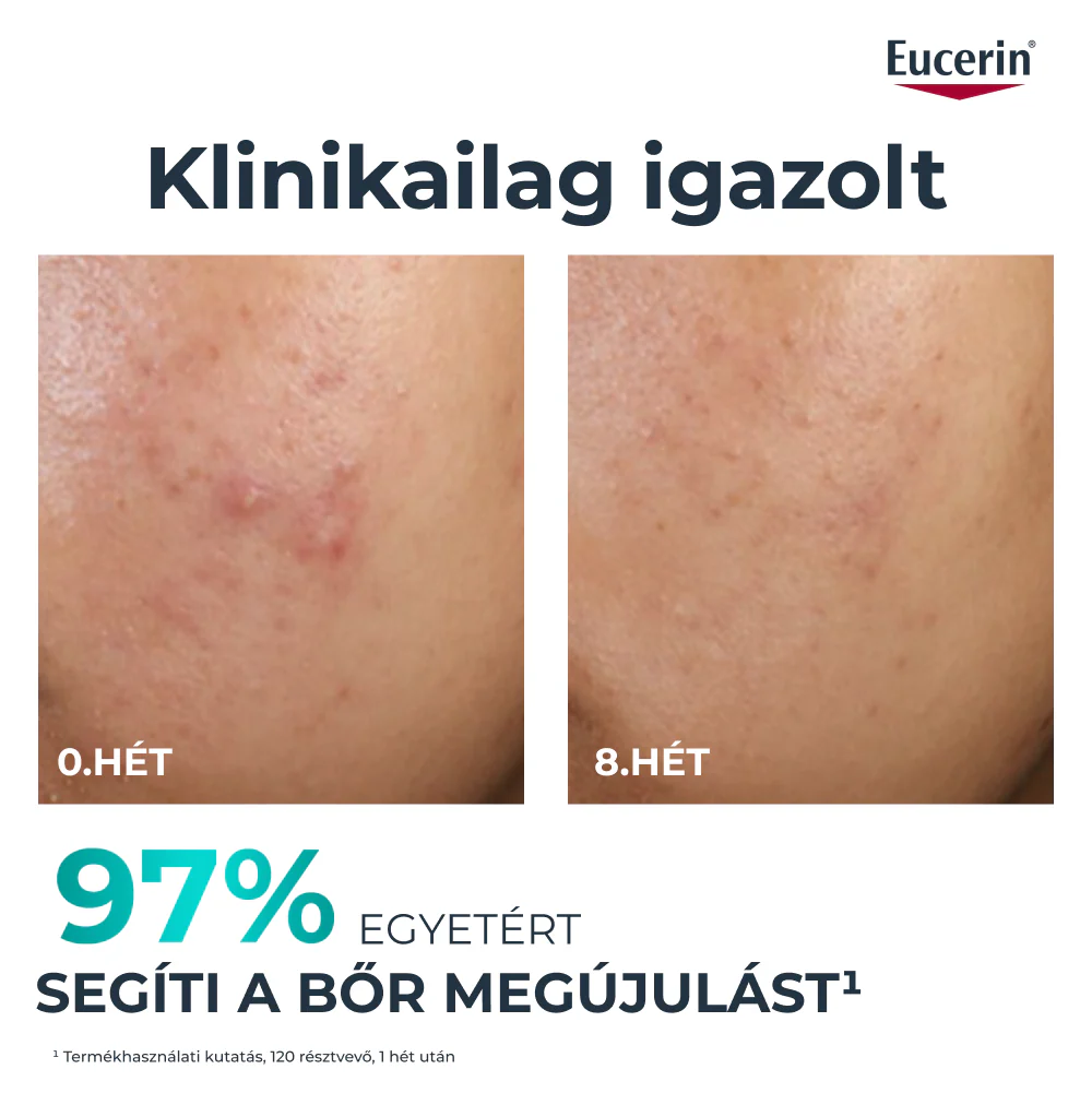 Eucerin DermoPure Clinical Peeling 10 - Bőrmegújító szérum 40ml - Image 2