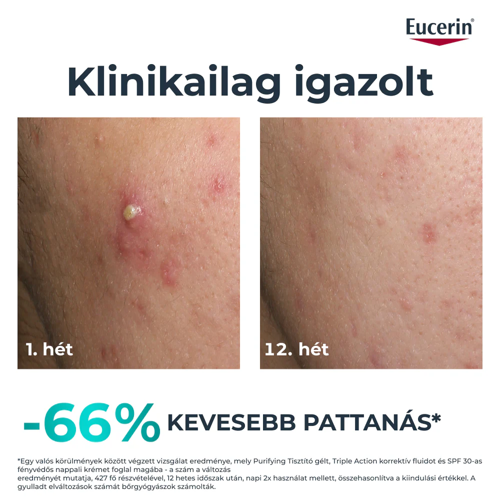 Eucerin DermoPure Clinical Triple Action - Korrektív Fluid 40ml - Image 2